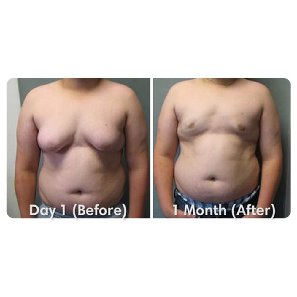 Gynecomastia Tightening Ginger Cream - Improves Elasticity & Burns Fats for Firm Male Chest Shape