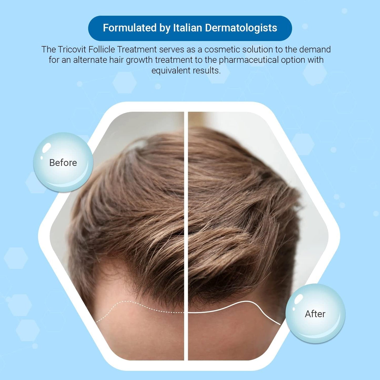 Hair Growth Supplement with Amino Acids, Minerals, and Antioxidants - Dermatologist-Formulated for Women & Men - Gluten-Free (60 tablets)