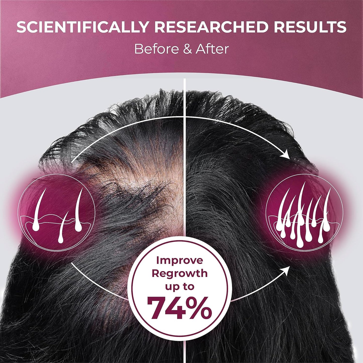 Hair Growth Supplement with Saw Palmetto, Biotin, L-Lysine, and Vitamins - Reduce Hair Loss and Promote Thicker Hair - Special Formula for Women - Easy to Use - 1 Bottle