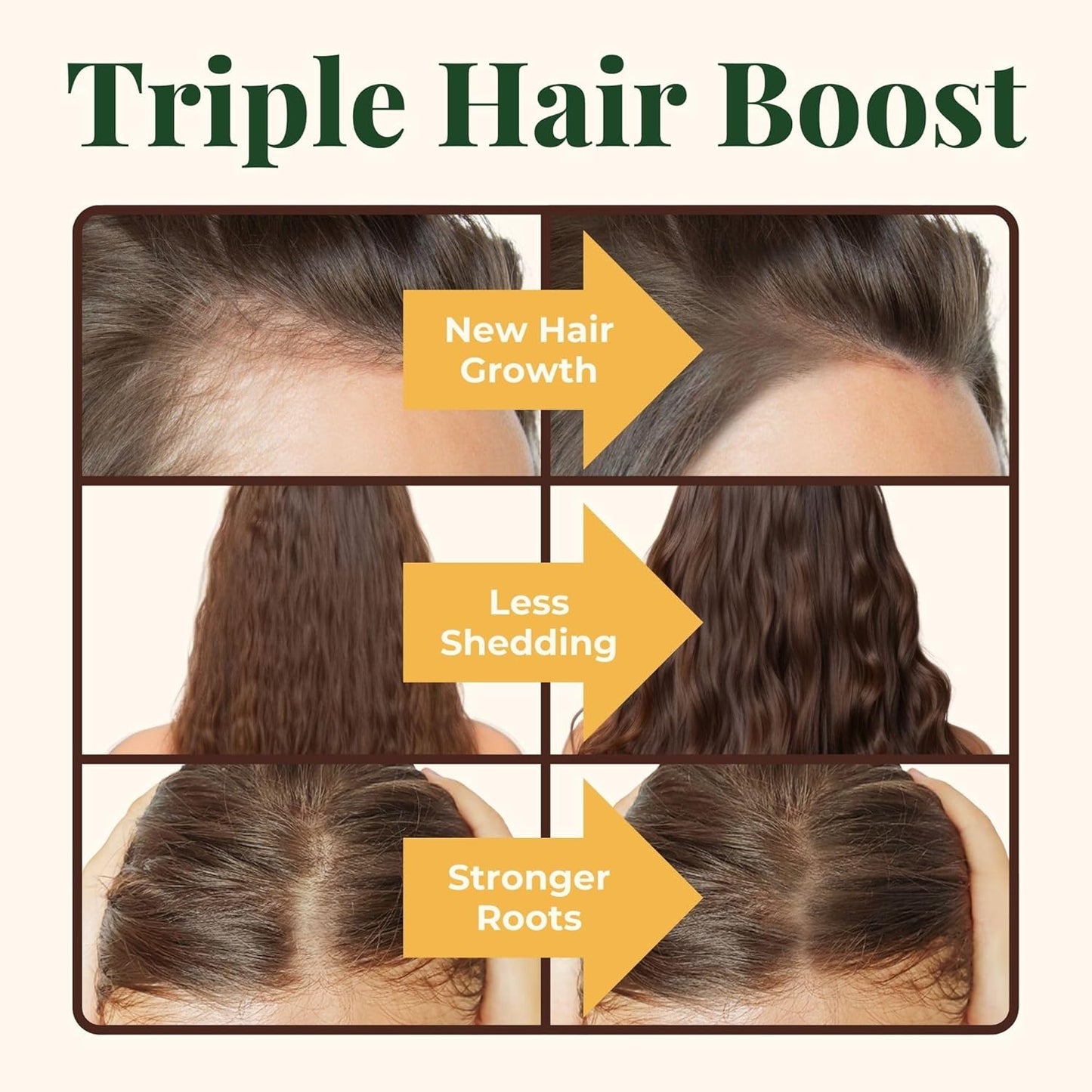 Hair Growth Supplements with Biotin 4000 mcg, DHT Blocker, and Collagen - 60 Tablets, 2 Month Supply - Heebin's Formula for Hair Loss and Regrowth