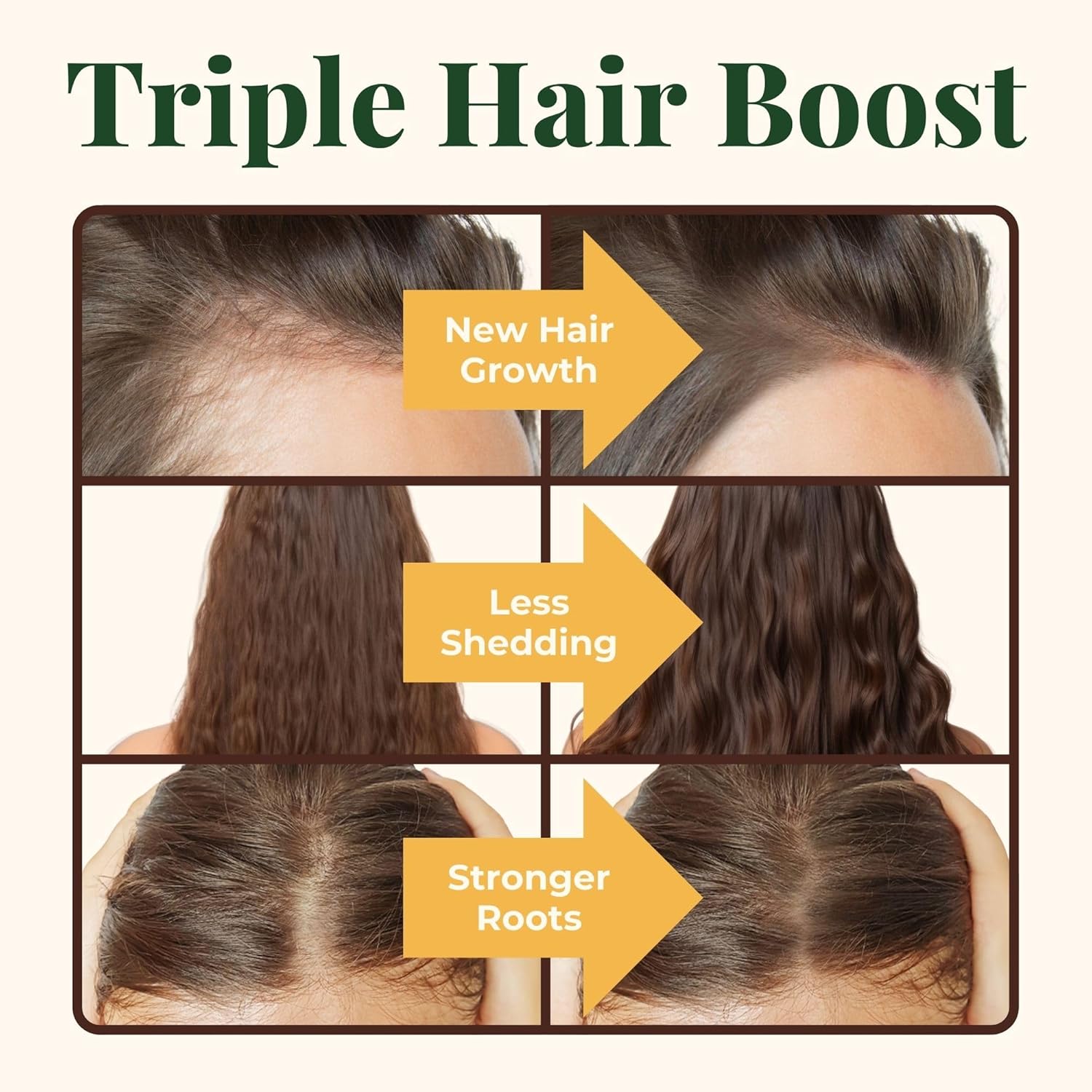Hair Growth Supplements with Biotin 4000 mcg, DHT Blocker, and Collagen - 60 Tablets, 2 Month Supply - Heebin's Formula for Hair Loss and Regrowth