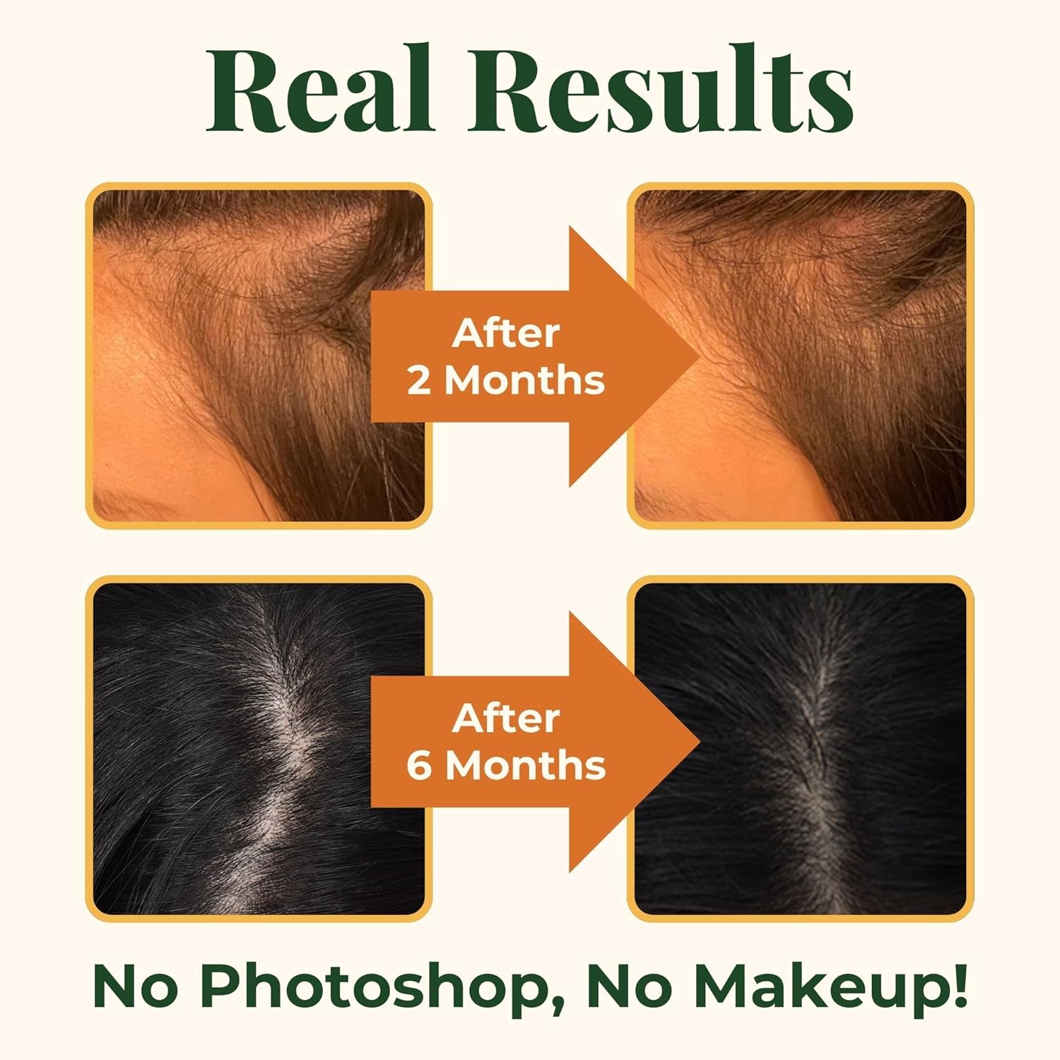 Hair Growth Supplements with Biotin 4000 mcg, DHT Blocker, and Collagen - 60 Tablets, 2 Month Supply - Heebin's Formula for Hair Loss and Regrowth