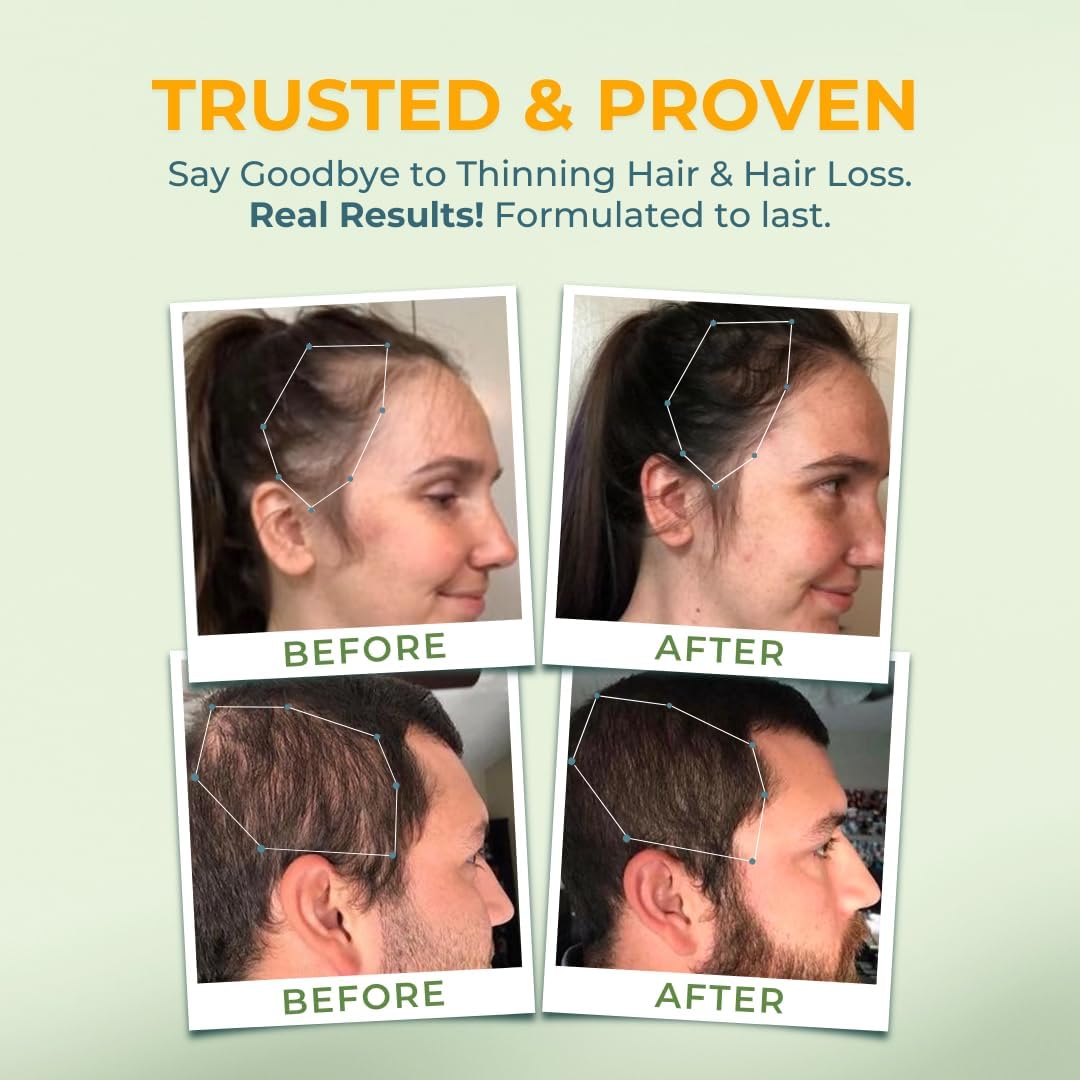 Hair Growth Vitamins with Biotin & Vitamin B for Healthy Hair, Skin & Nails - Hormone-Free & Gluten-Free Hair Supplement for Women & Men