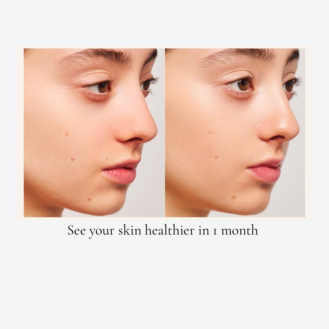 Hydrating Skin Supplement Capsules with Hyaluronic Acid, Collagen, and Niacinamide - Promotes Healthy Glow and Supports Dry Skin