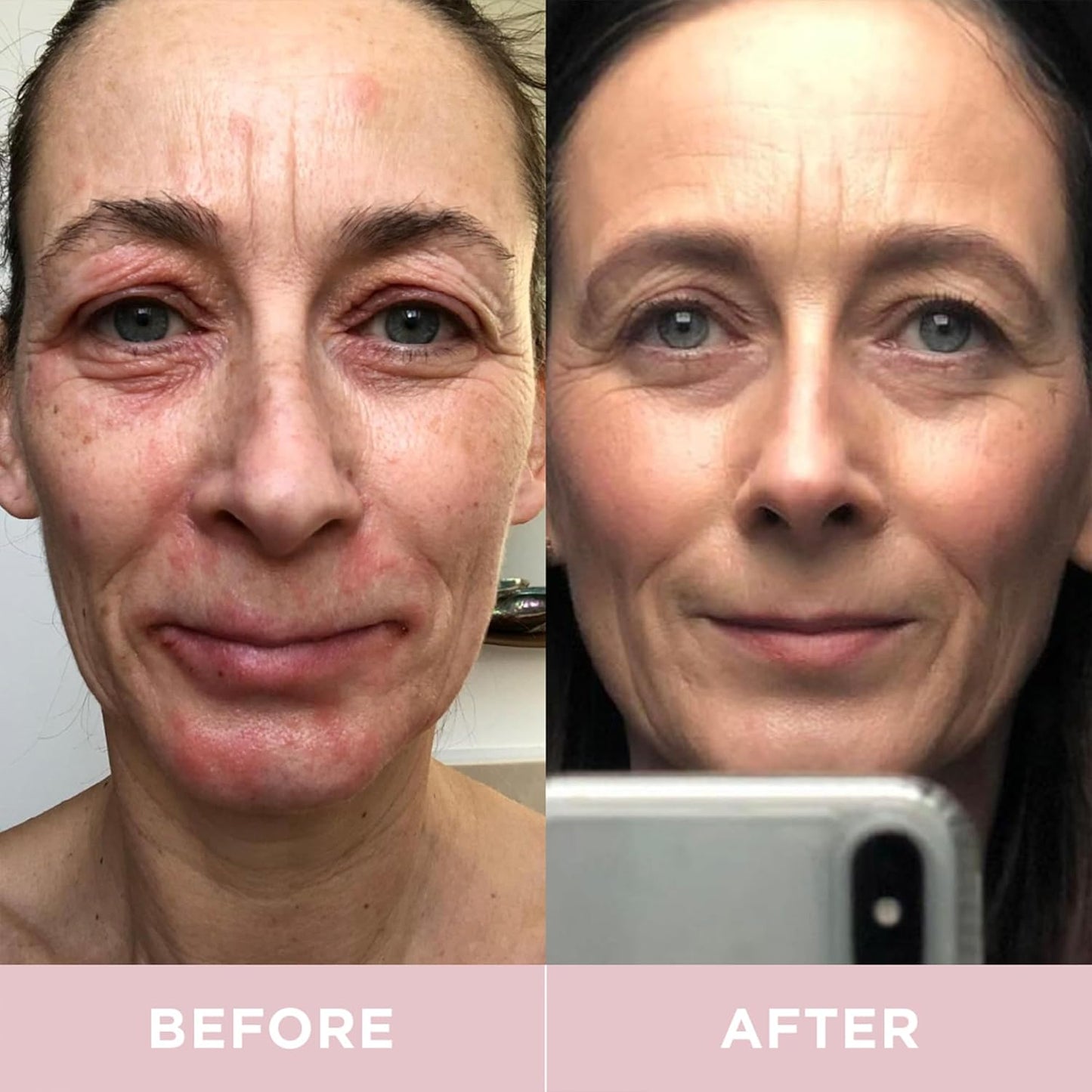 Hydrolyzed Marine Collagen Drink with Hyaluronic Acid & Aloe Vera for Skin, Hair, Nails & Joints - Lemon & Lime - 28 Day Supply