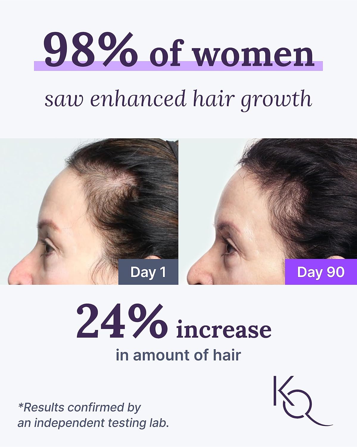 Keranique Hair & Scalp Supplements - Boost Strength and Growth with Biotin, Vitamin B, and Vital Nutrients