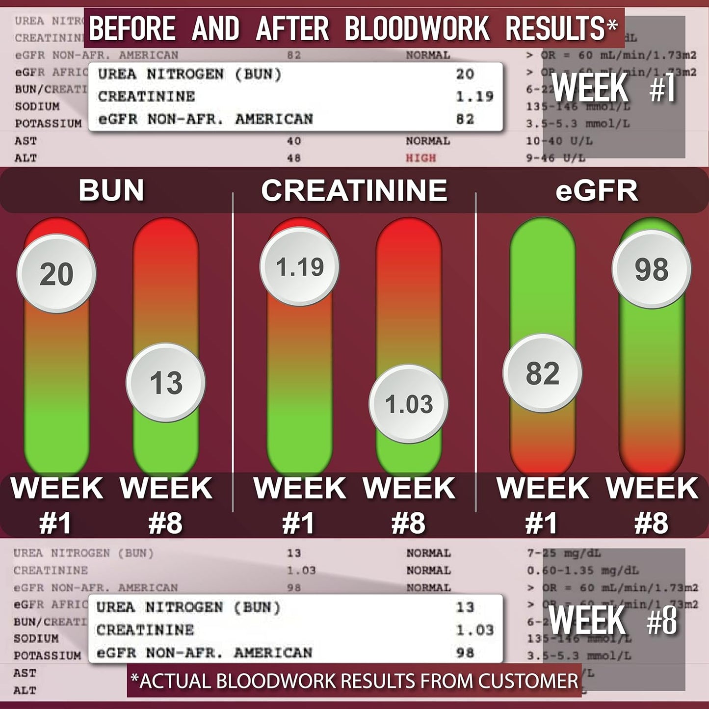 Leviathan Nutrition Super Kidney Cleanse & Urinary Detox Formula - Promotes Optimal Kidney Health, Gallbladder Support, Detox & Stone Management | 120 Capsules