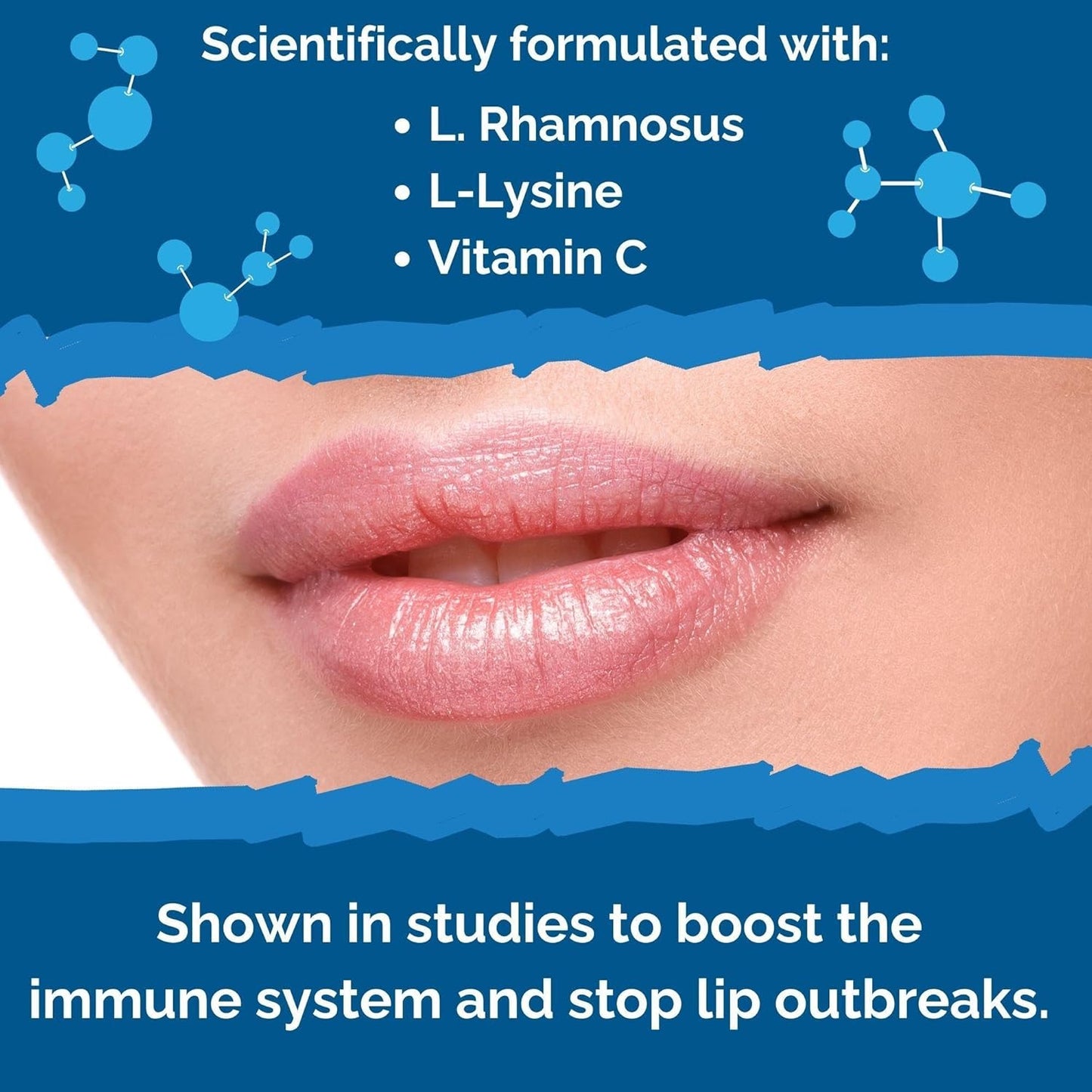 Lysine Probiotic Cold Sore Treatment for Lips with Vitamin C - Immune Support for Clear Skin and Lip Health