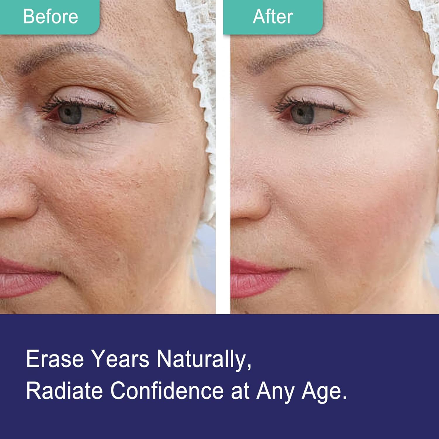 NEVISS Nicotinamide 500mg Gummies with Collagen Peptides for Healthy Aging, NAD+ Boost, and Brain Health, 120 Count