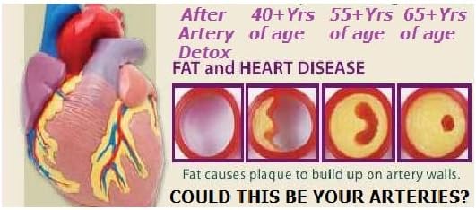 Orange Flavor Artery Detox Supplement - Natural Heart Health Support for Arterial Cleanse and Circulation Boost