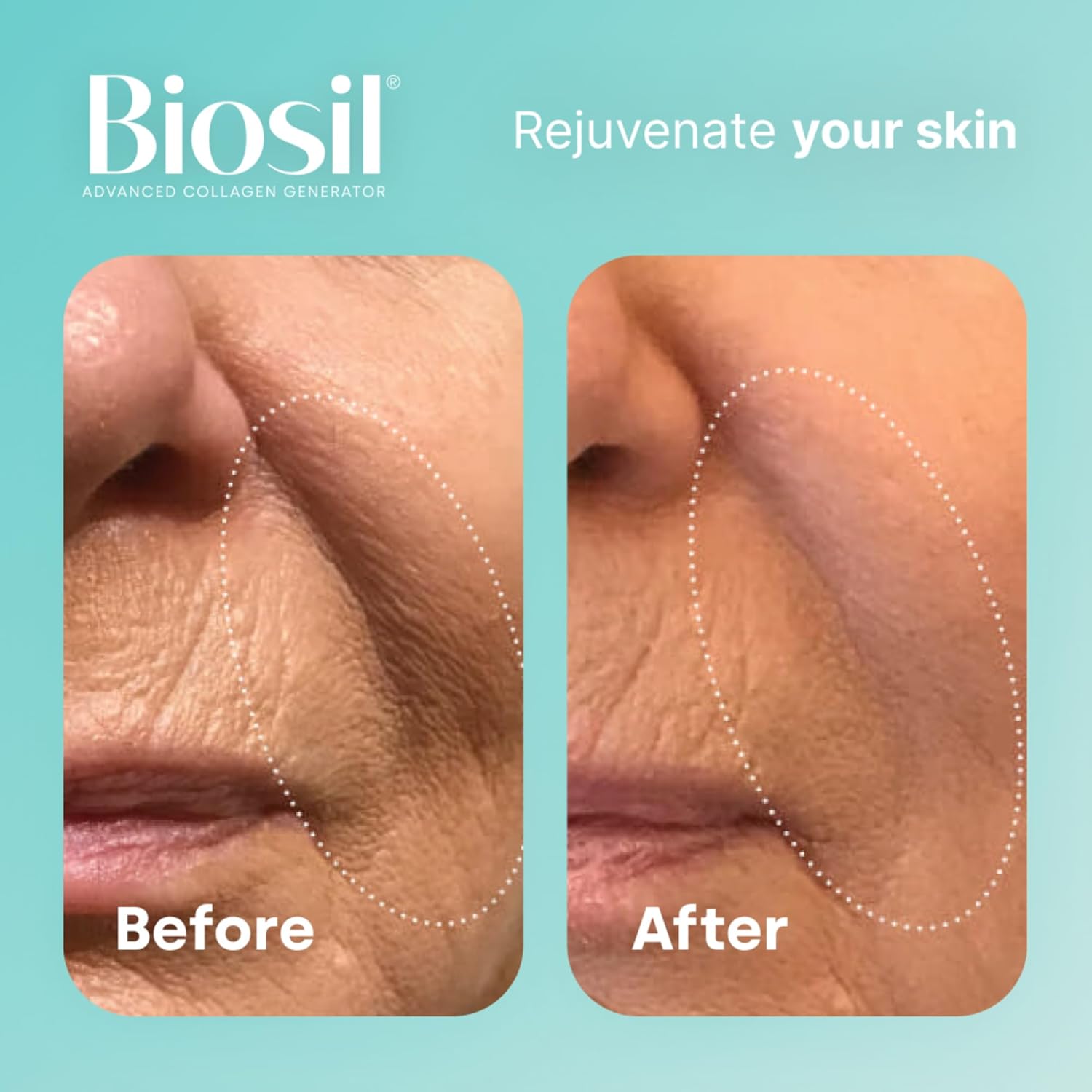 Pack of 2 Biosil Collagen Generator Liquid Capsules with Patented ch-OSA Complex - Generate & Protect Collagen - GMO Free - 60-Day Supply