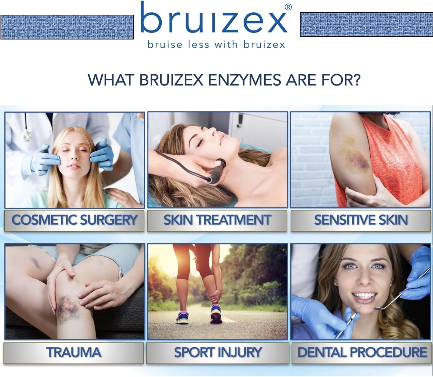 Proteolytic Enzymes Supplement for Tissue Trauma Recovery, Bruising, Swelling | Immune System Support - 60 Capsules