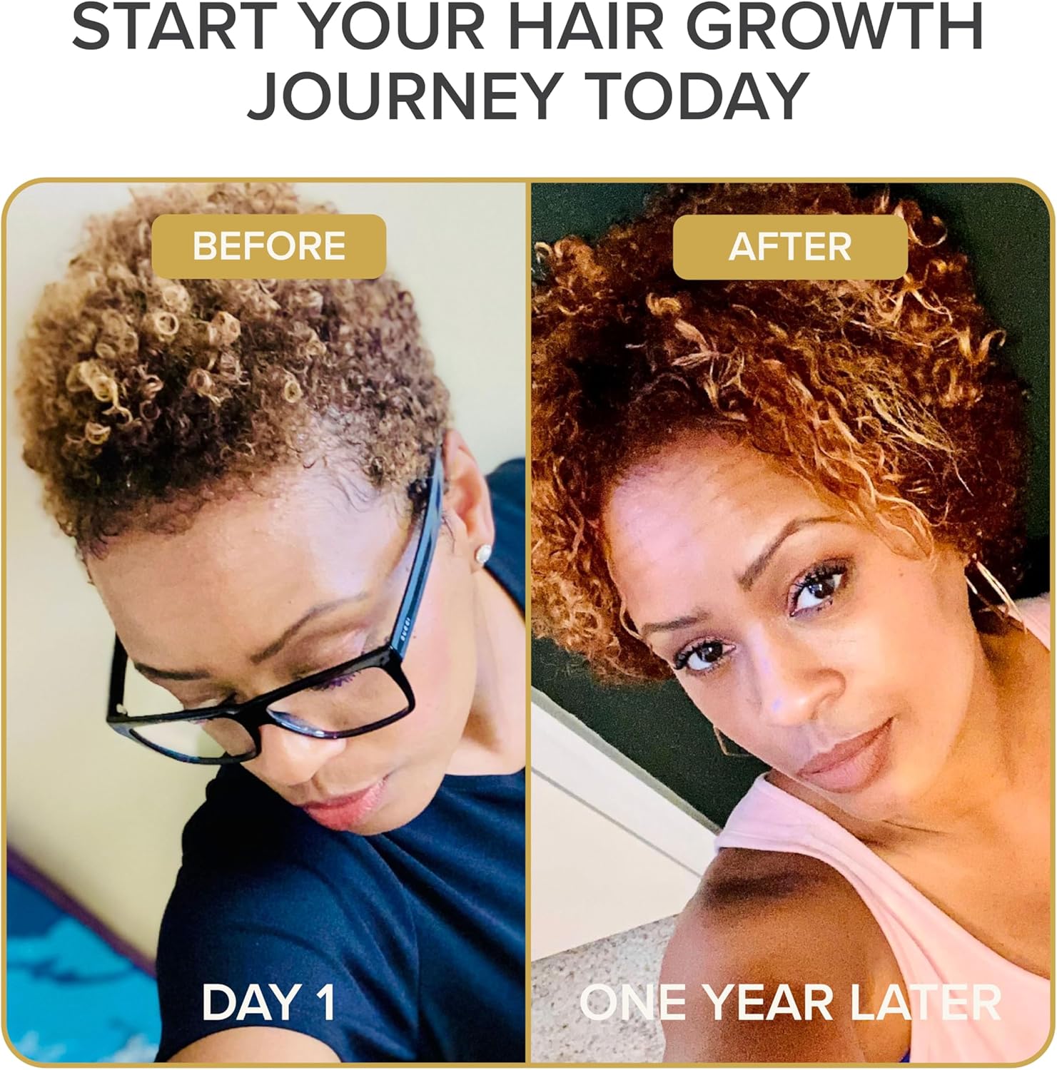 Shedavi Iconic Natural Hair Vitamins - Fast Hair Growth Supplement for Thicker, Stronger Hair - Vegan Formula for Hair Loss - Non-GMO Hair Care (60 Capsules)