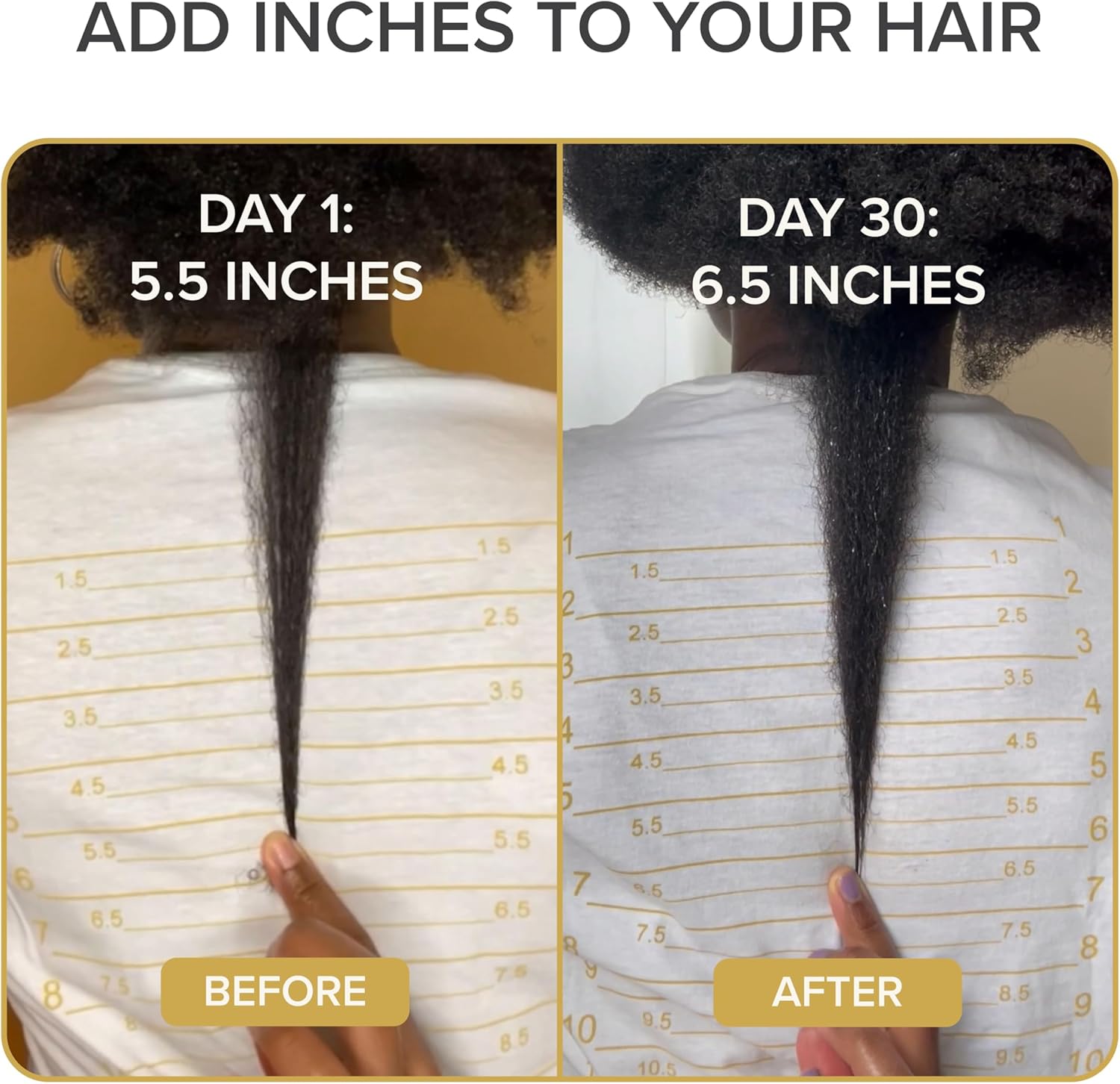 Shedavi Iconic Natural Hair Vitamins - Fast Hair Growth Supplement for Thicker, Stronger Hair - Vegan Formula for Hair Loss - Non-GMO Hair Care (60 Capsules)