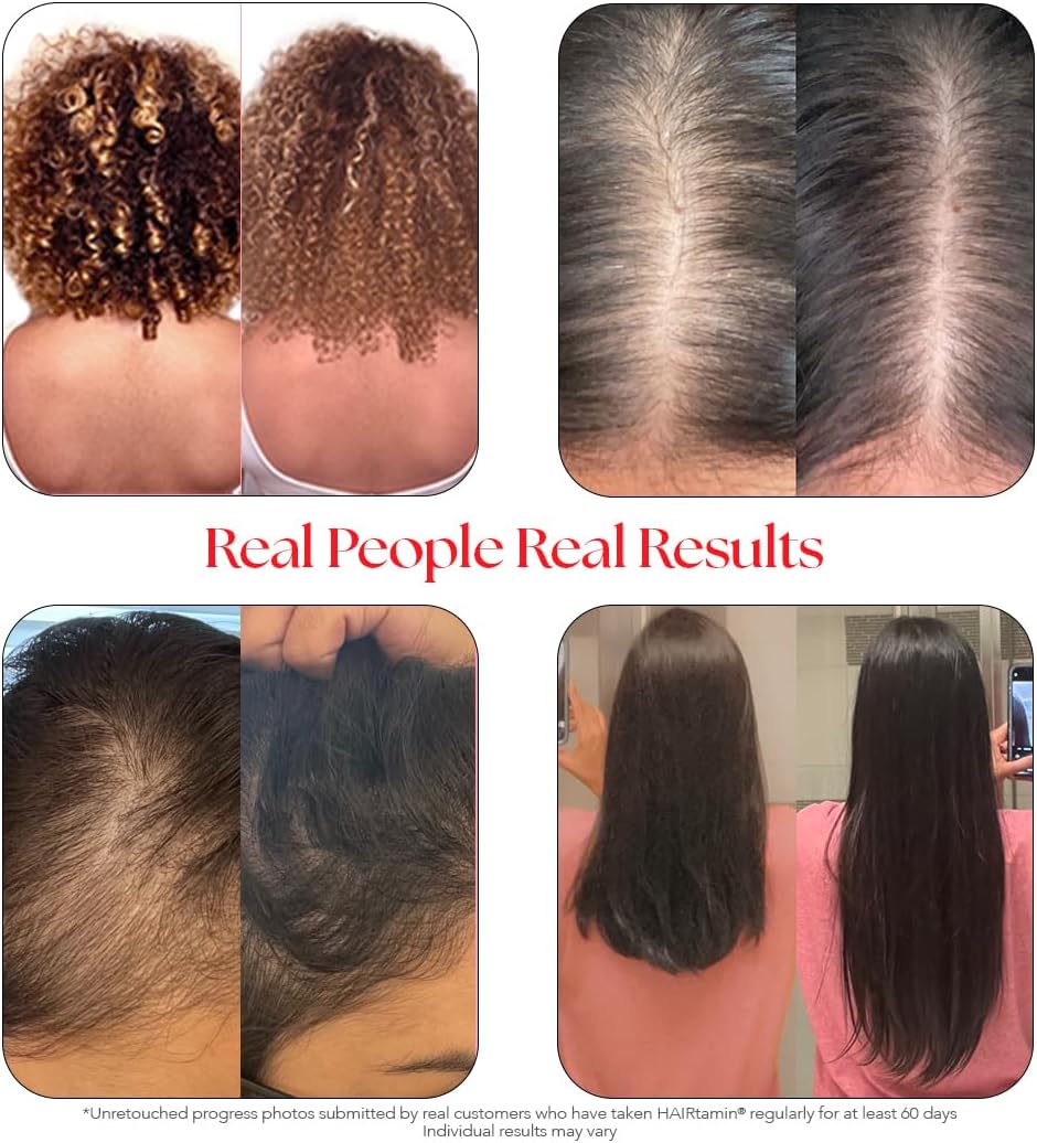 Vegan Biotin Capsules for Hair Growth & Health - Reduce Thinning & Loss - 30 Capsules