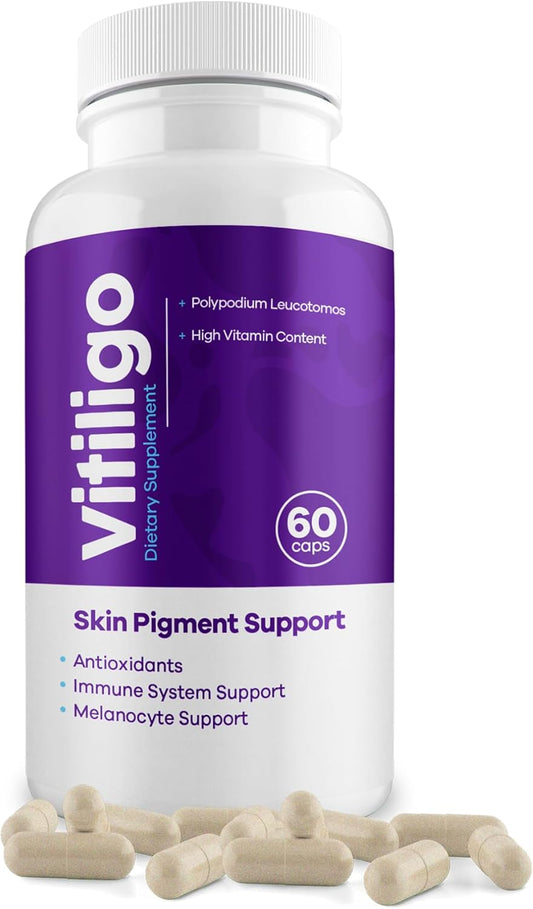 Vitiligo Supplement Capsules for Skin Pigmentation Support | 60 Count | Reduce White Spots | Natural Solution for Vitiligo | 1 Month Supply