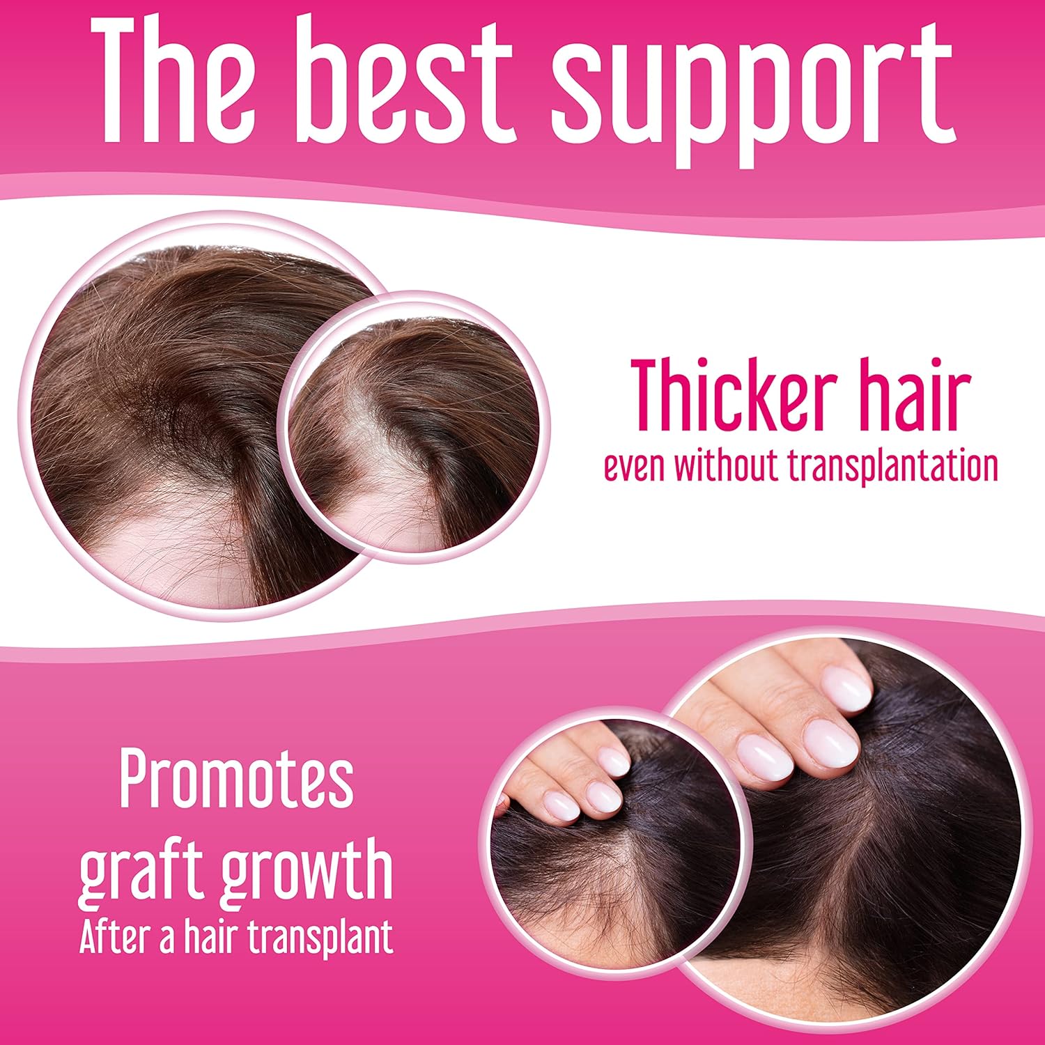 Women's Hair Loss Supplement - DHT Blocker & Hair Growth Formula - 60 Tablets