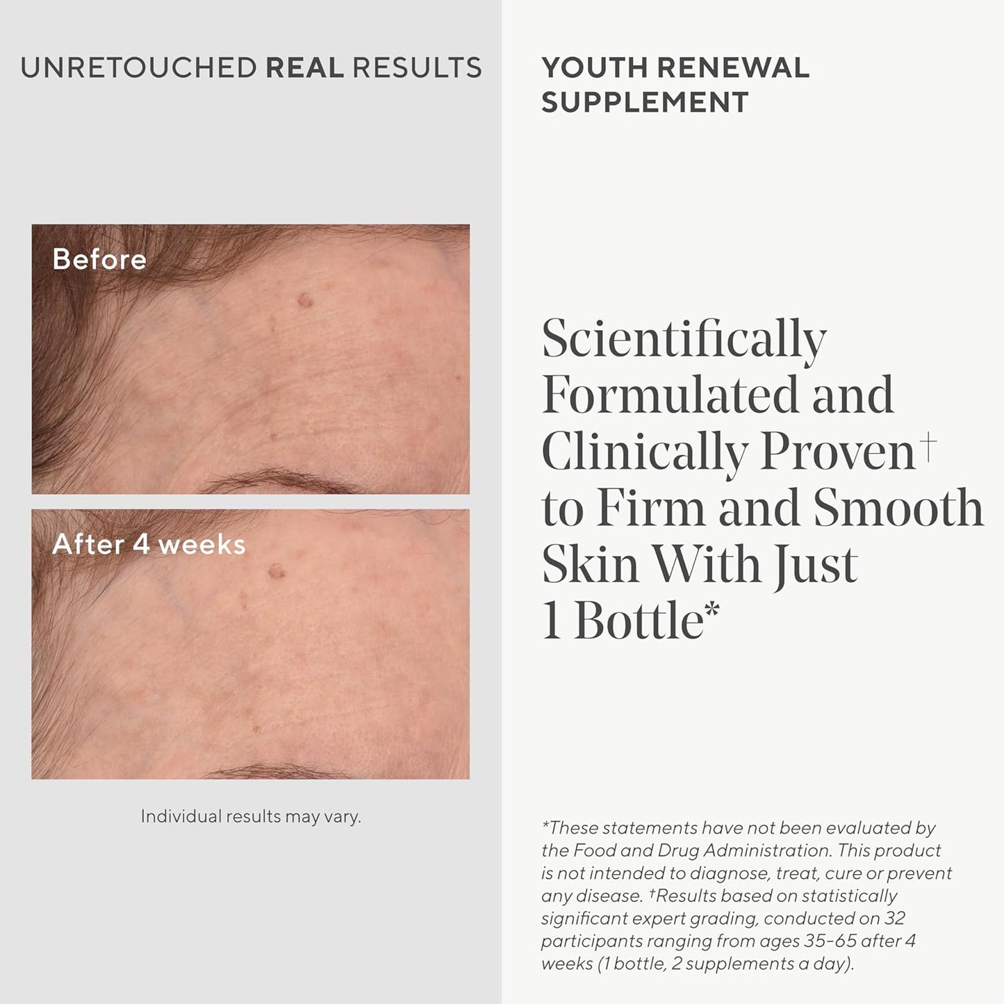 Youth Renewal Supplement for Plump Skin - Anti-Aging Beauty Solution with Collagen and Ceramides to Reduce Wrinkles and Fine Lines
